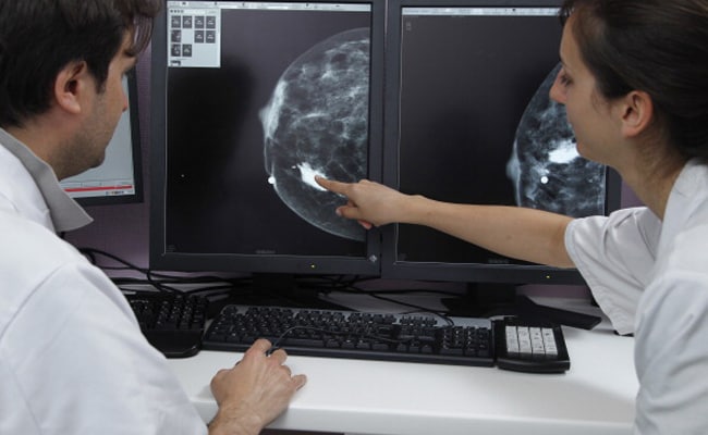 mitos-mamografia1