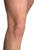 Ejercicios de rodilla por desgaste de cartilago operacion