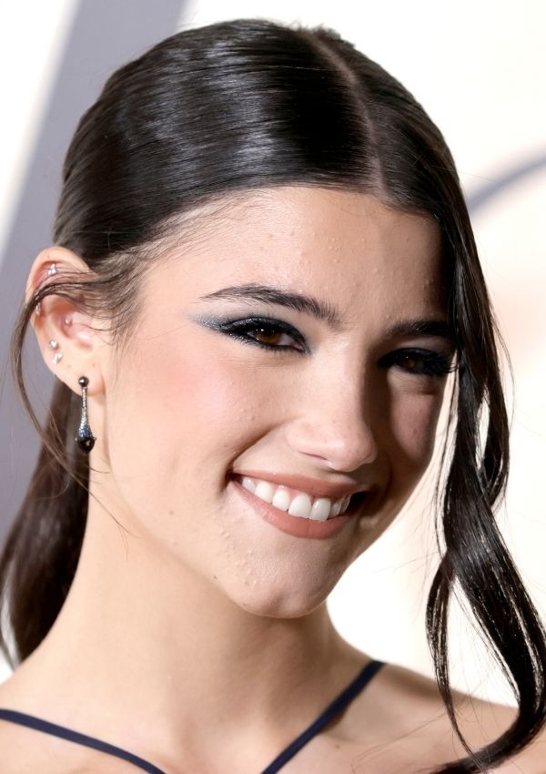 Charlie D Amelio No Edita Sus Fotos En Redes Para Visibilizar El Acne