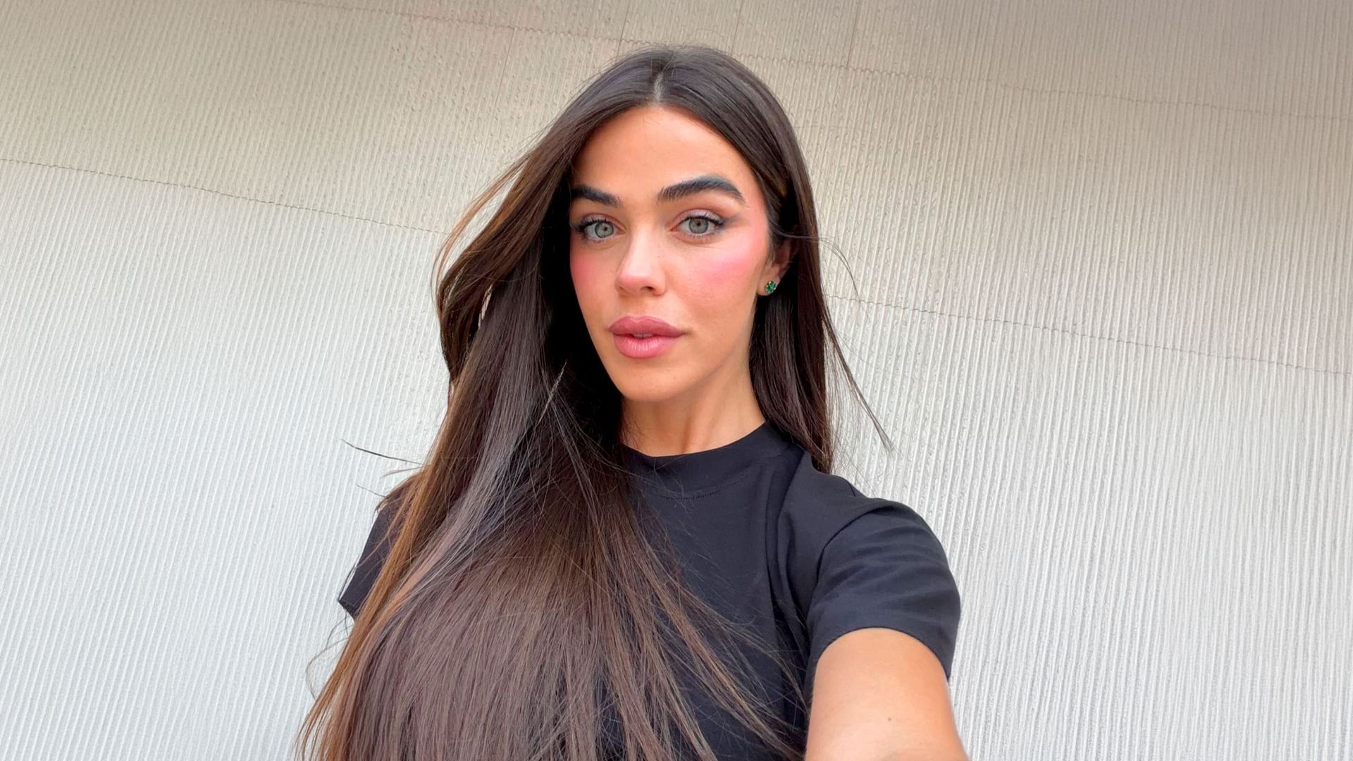 Violeta Mangriñán habla de su melasma