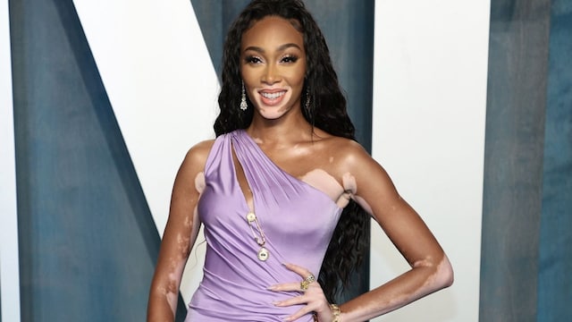 vitiligo