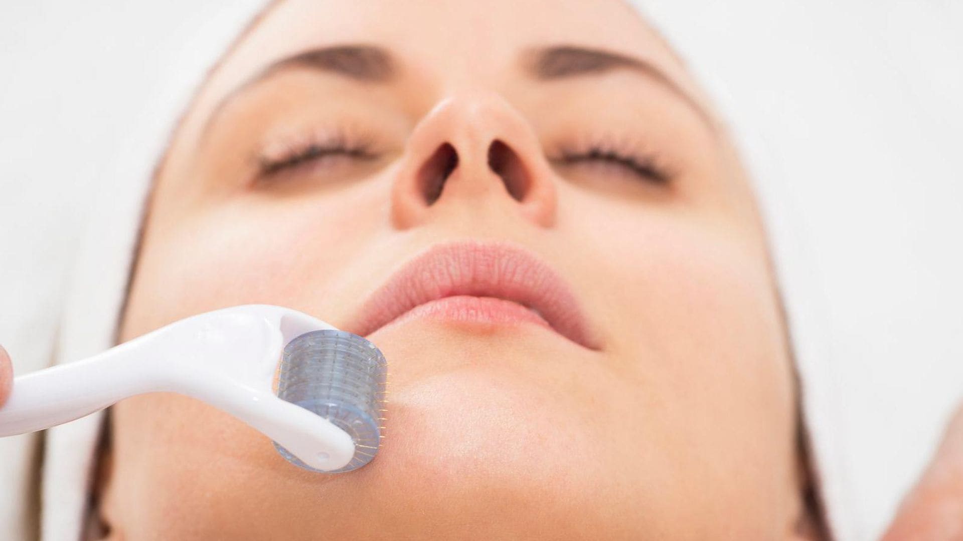 Microneedling, el tratamiento que está de moda entre las celebs