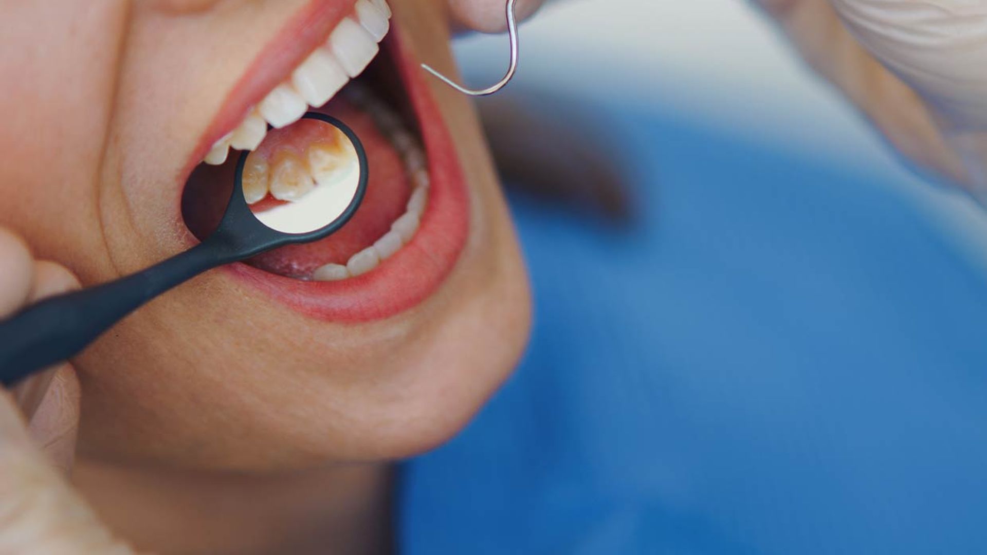dental