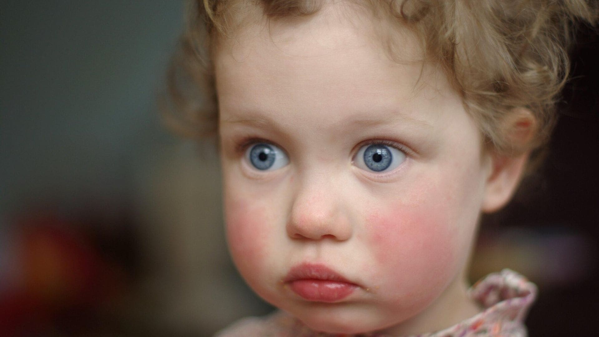 ¿Qué es el megaloeritema y cómo afecta a los niños?