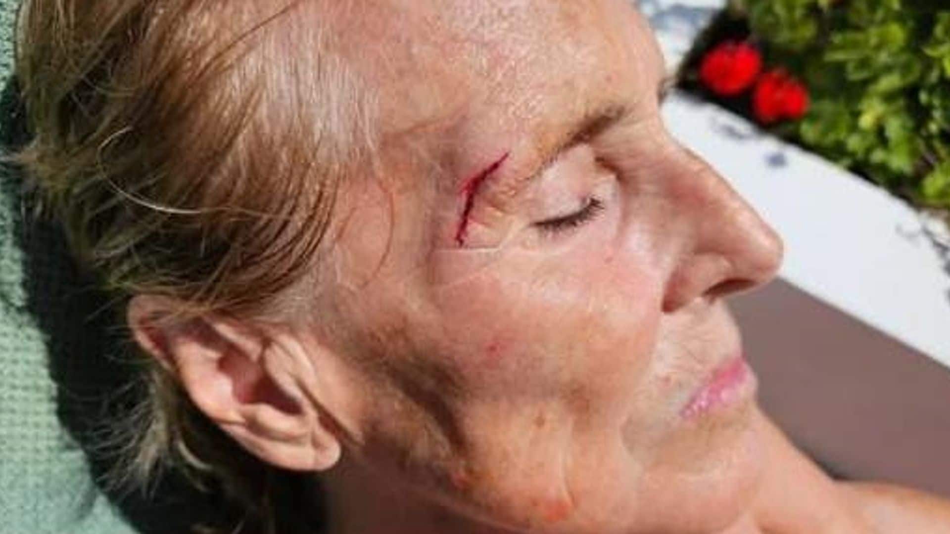 El susto de Mercedes Milá en su propia casa: "Me he caído en el patio"