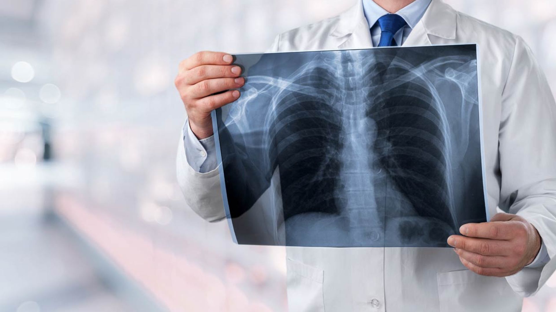 Síntomas del cáncer de pulmón, una enfermedad que cada vez afecta a más personas no fumadoras