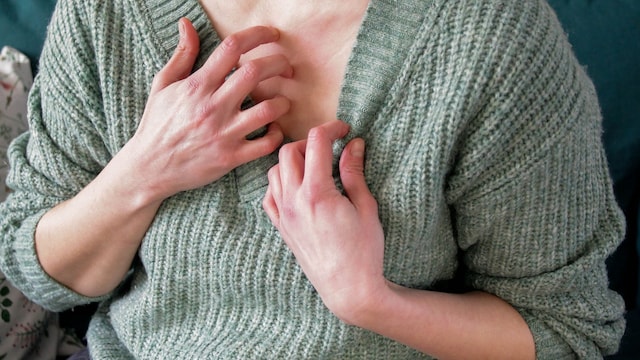 mujer rascándose con picores en el escote