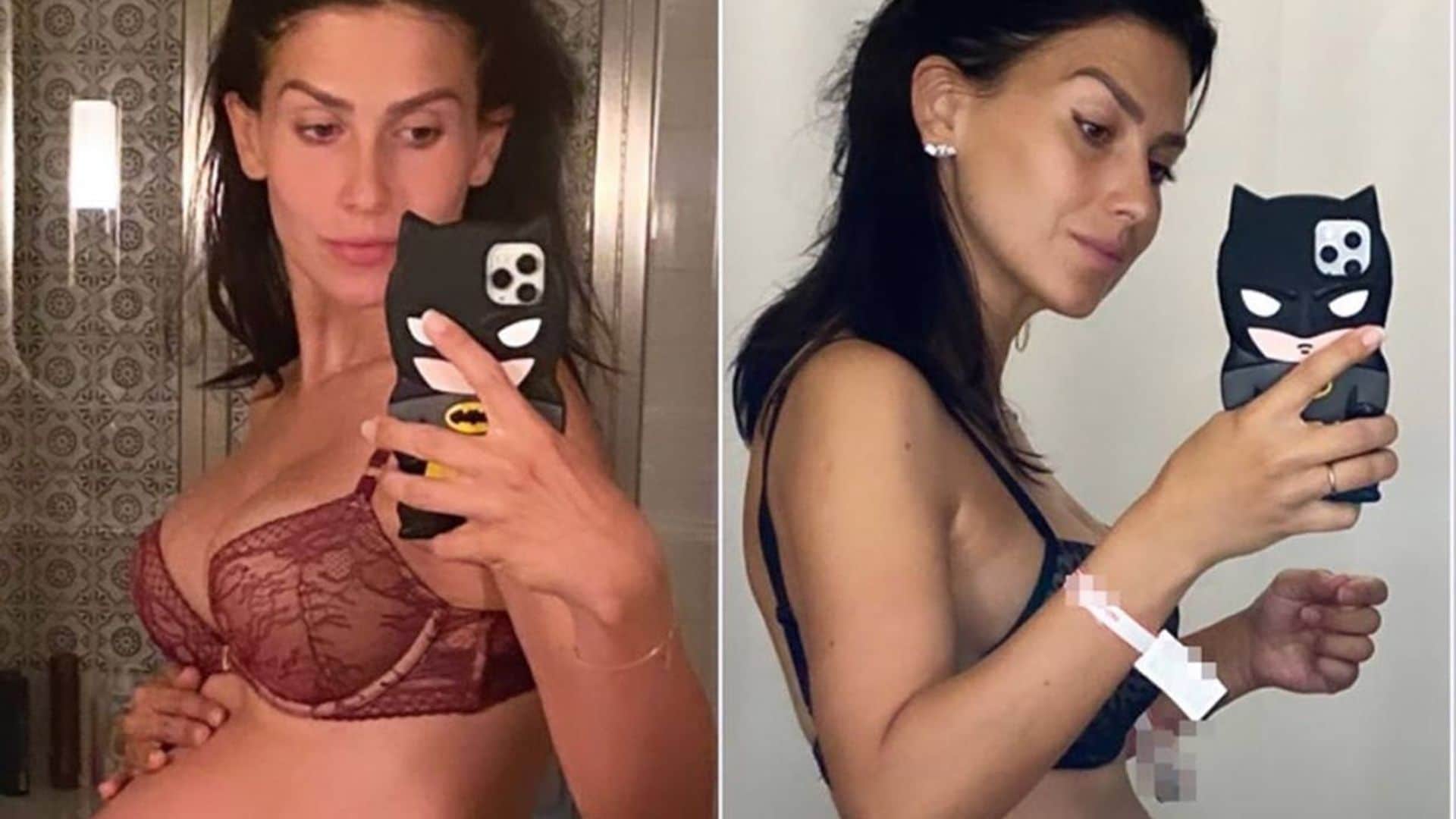 Hilaria Baldwin comparte el antes y el después de su cuerpo tras dar a luz a su quinto hijo