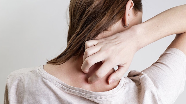 psoriasis felicidad
