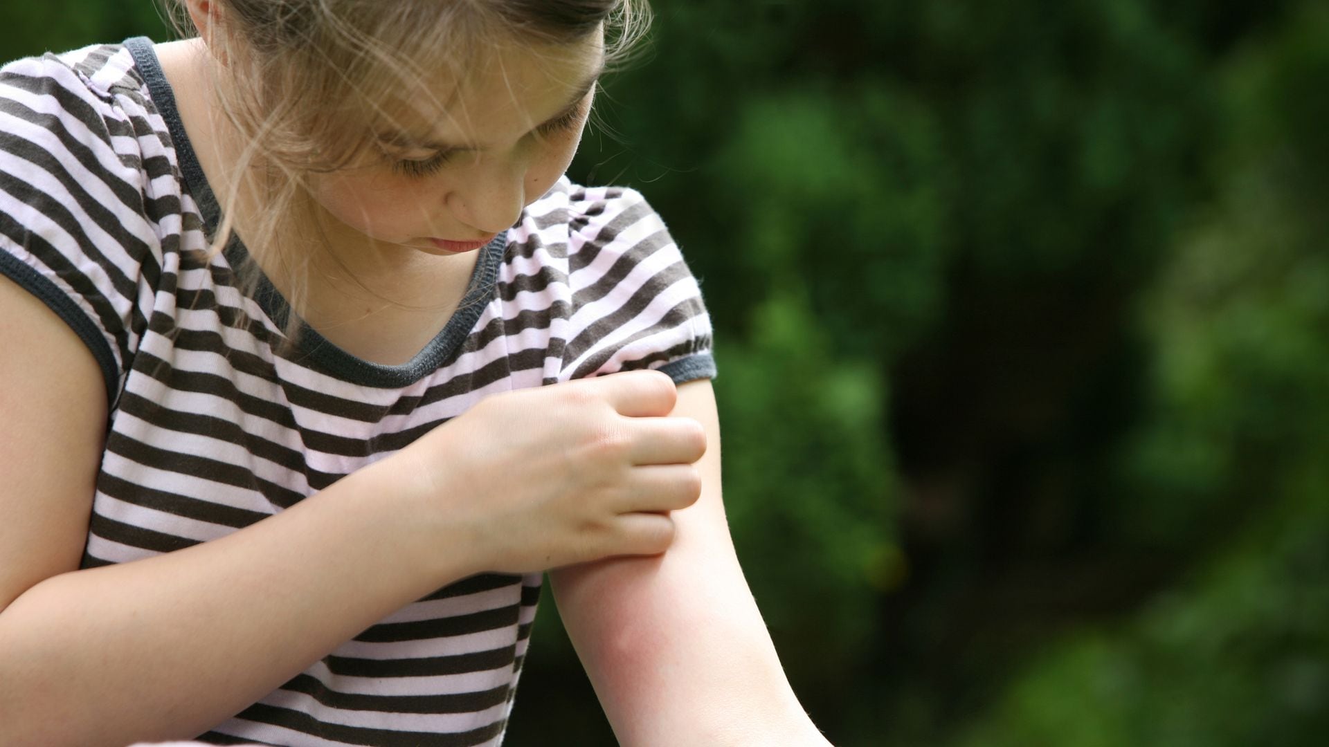 Niña se rasca una picadura