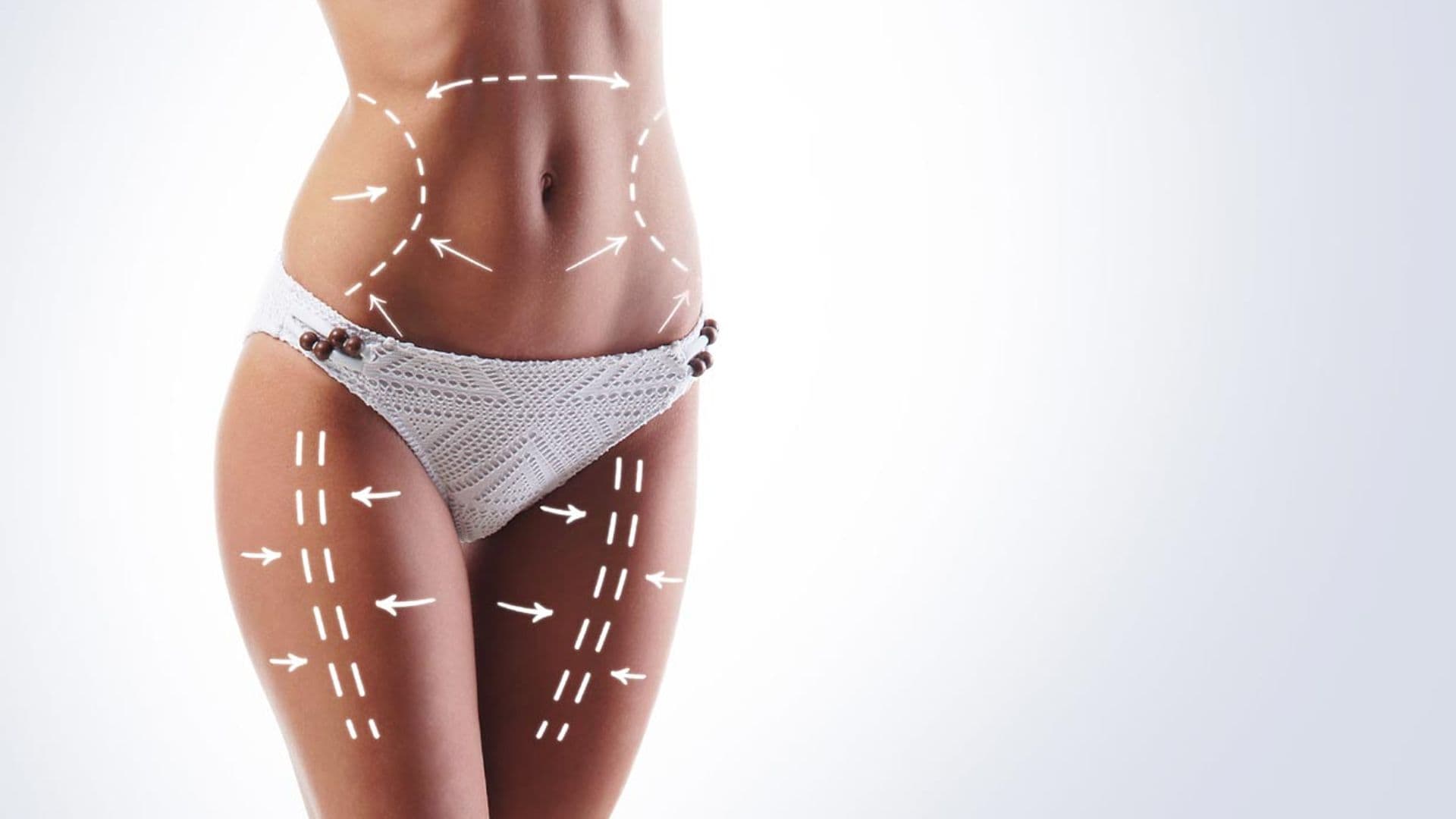 ¿Estás pensando en una liposucción? Estas son las recomendaciones de los expertos