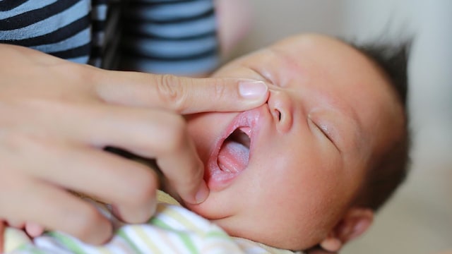 beb con ampolla en el labio en brazos de su madre