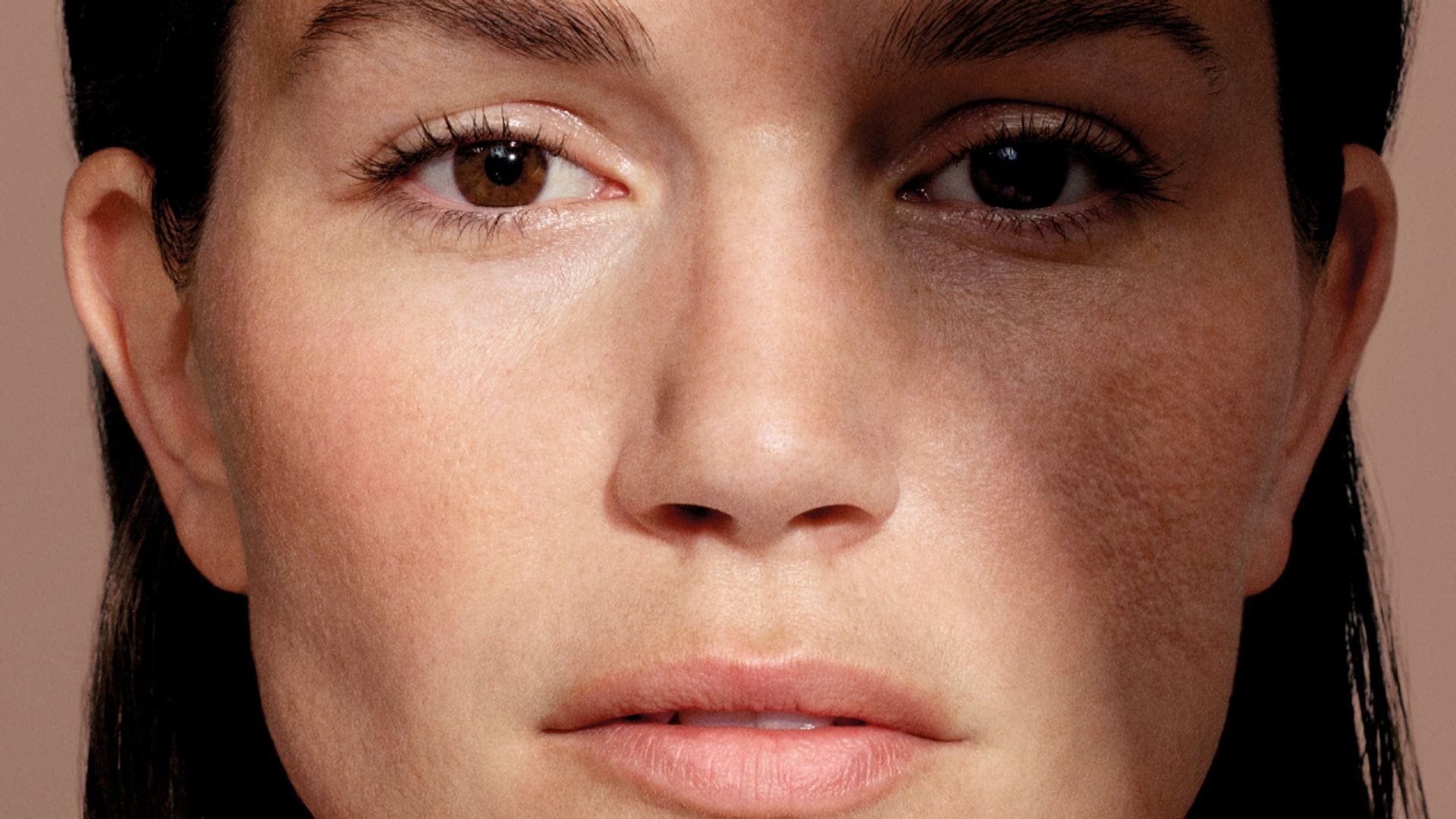 Mesoestetic