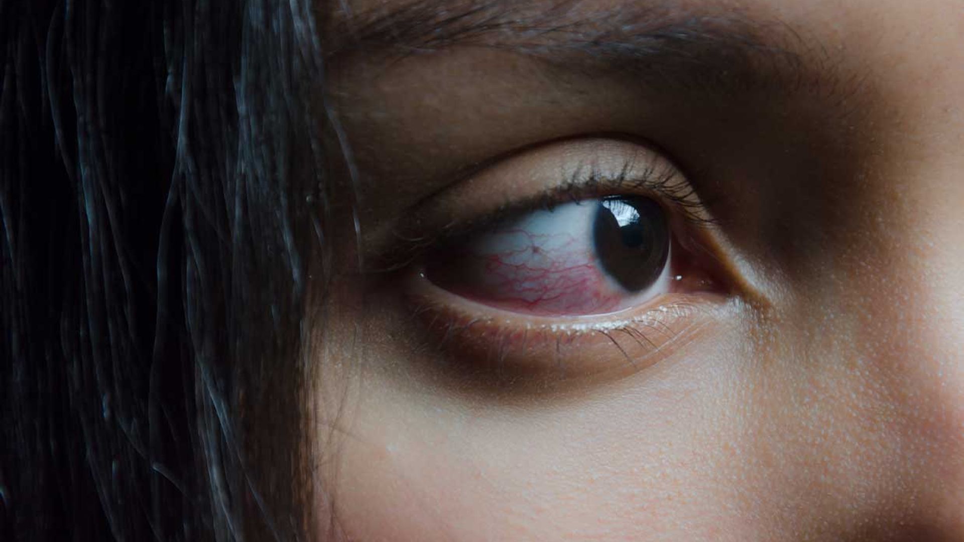 ojo irritado