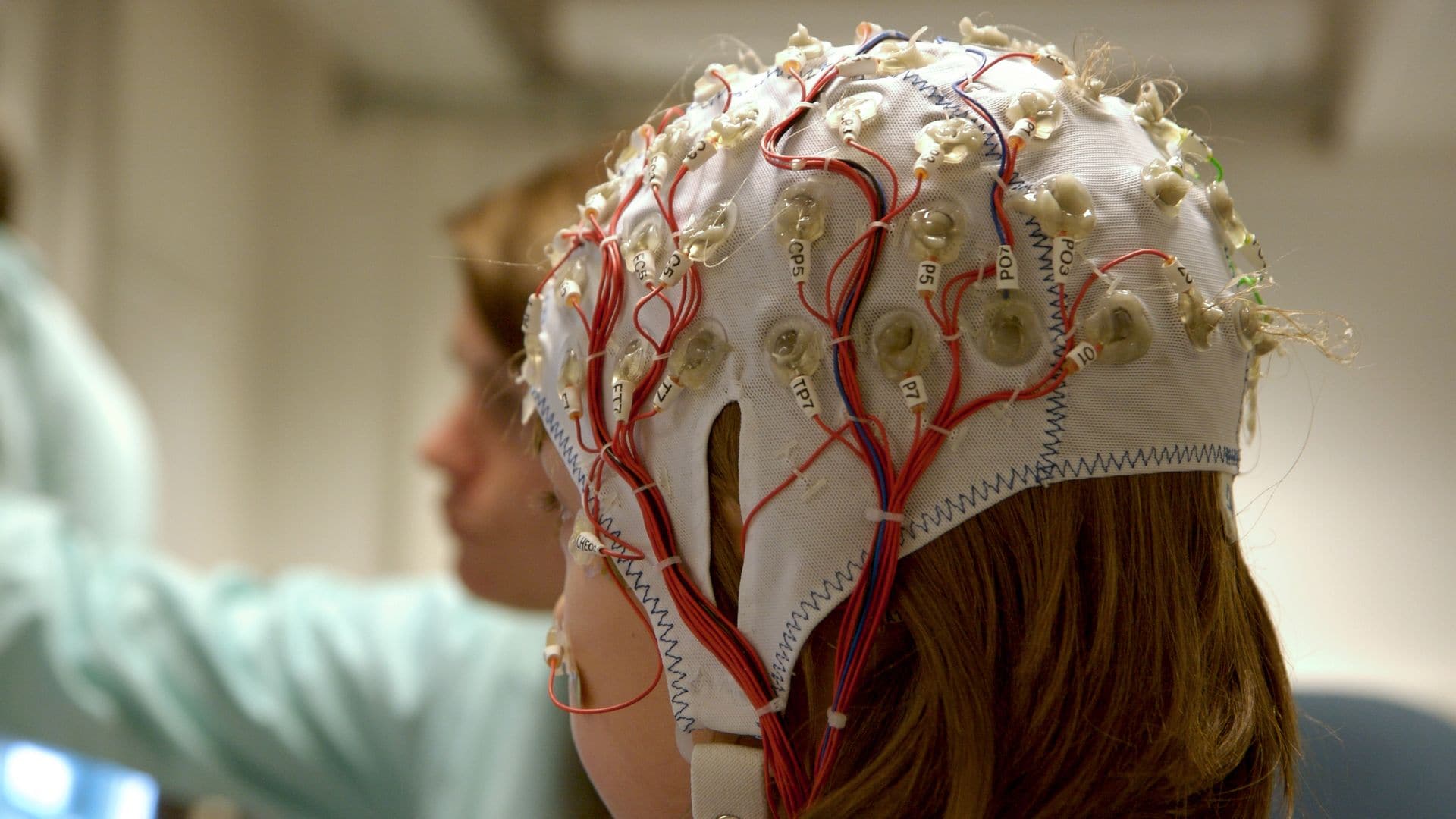 Neuromodulación