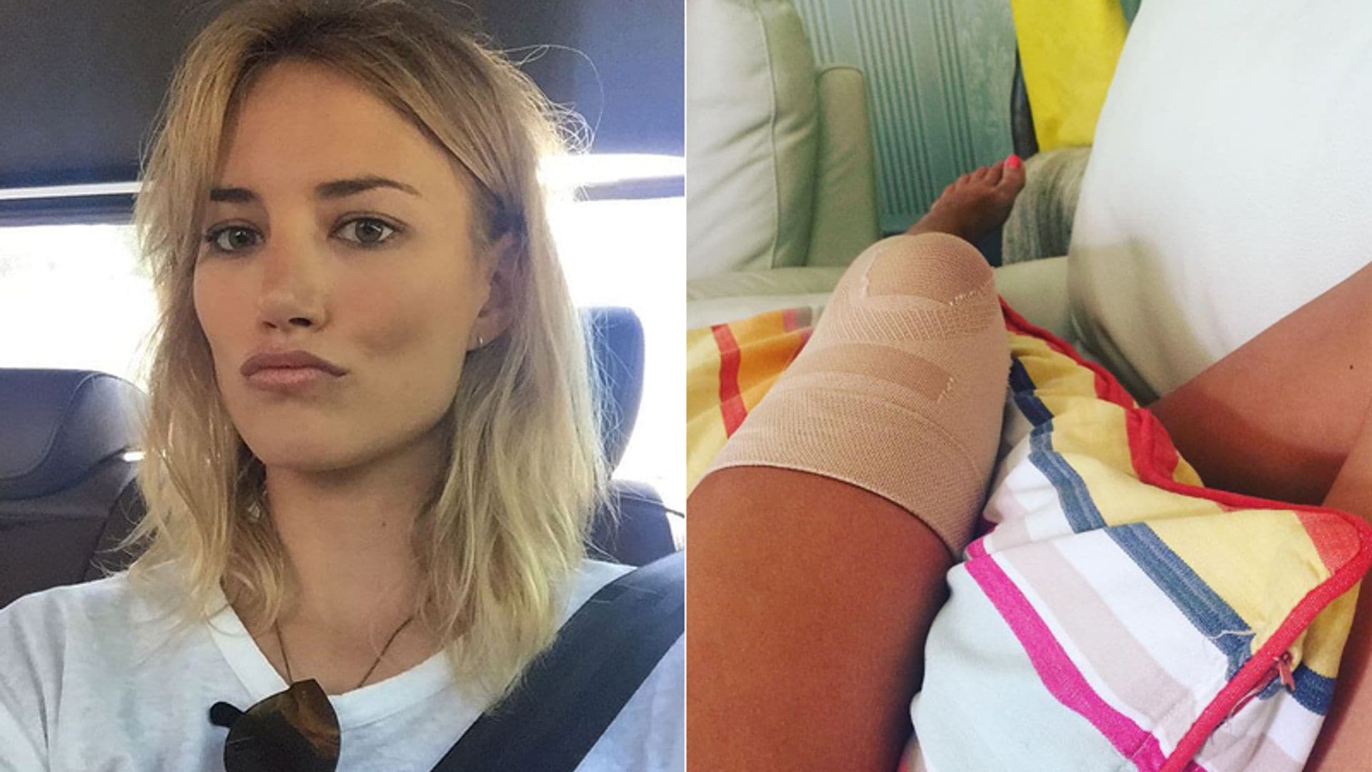 Alba Carrillo se recupera del golpe por el que acabó en el hospital