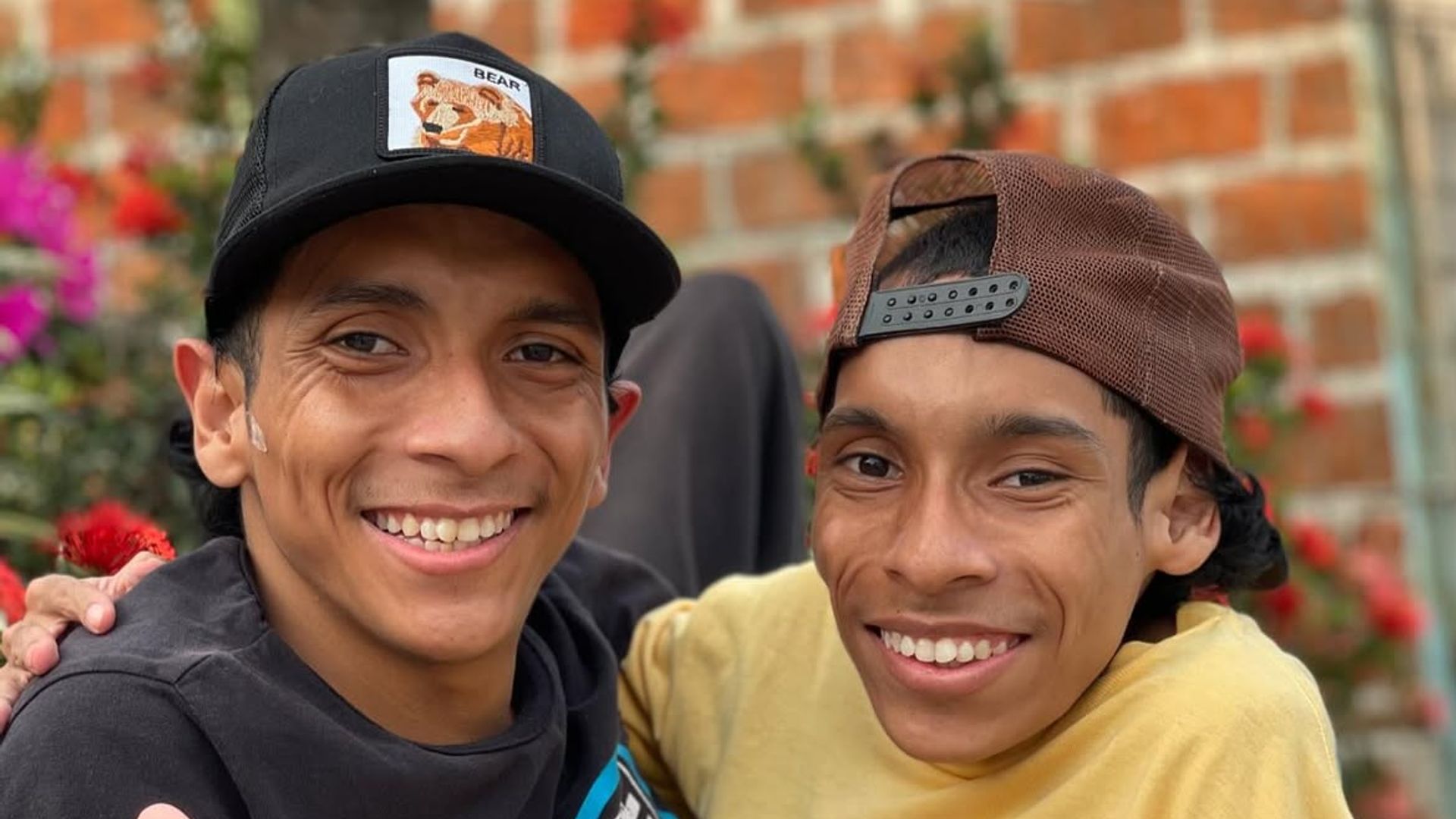 Mueren a los 27 años José Luis y José Armando, los hermanos siameses que desafiaron todos los pronósticos