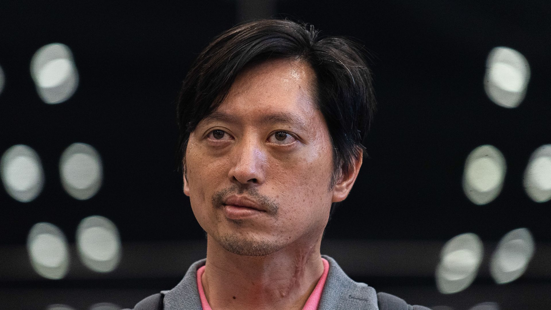 Chakriwat Vivacharawongse afronta en la UCI una compleja neurocirugía de urgencia en Malasia