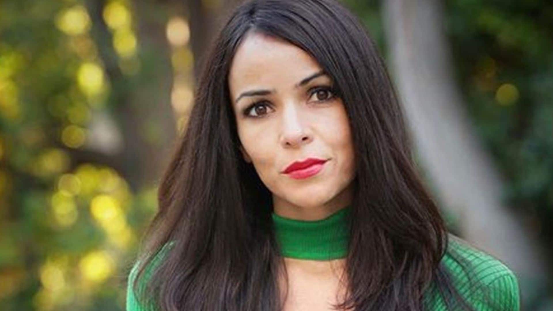 Raquel del Rosario muestras las secuelas de su hijo cuatro meses después de ser atacado por un puma