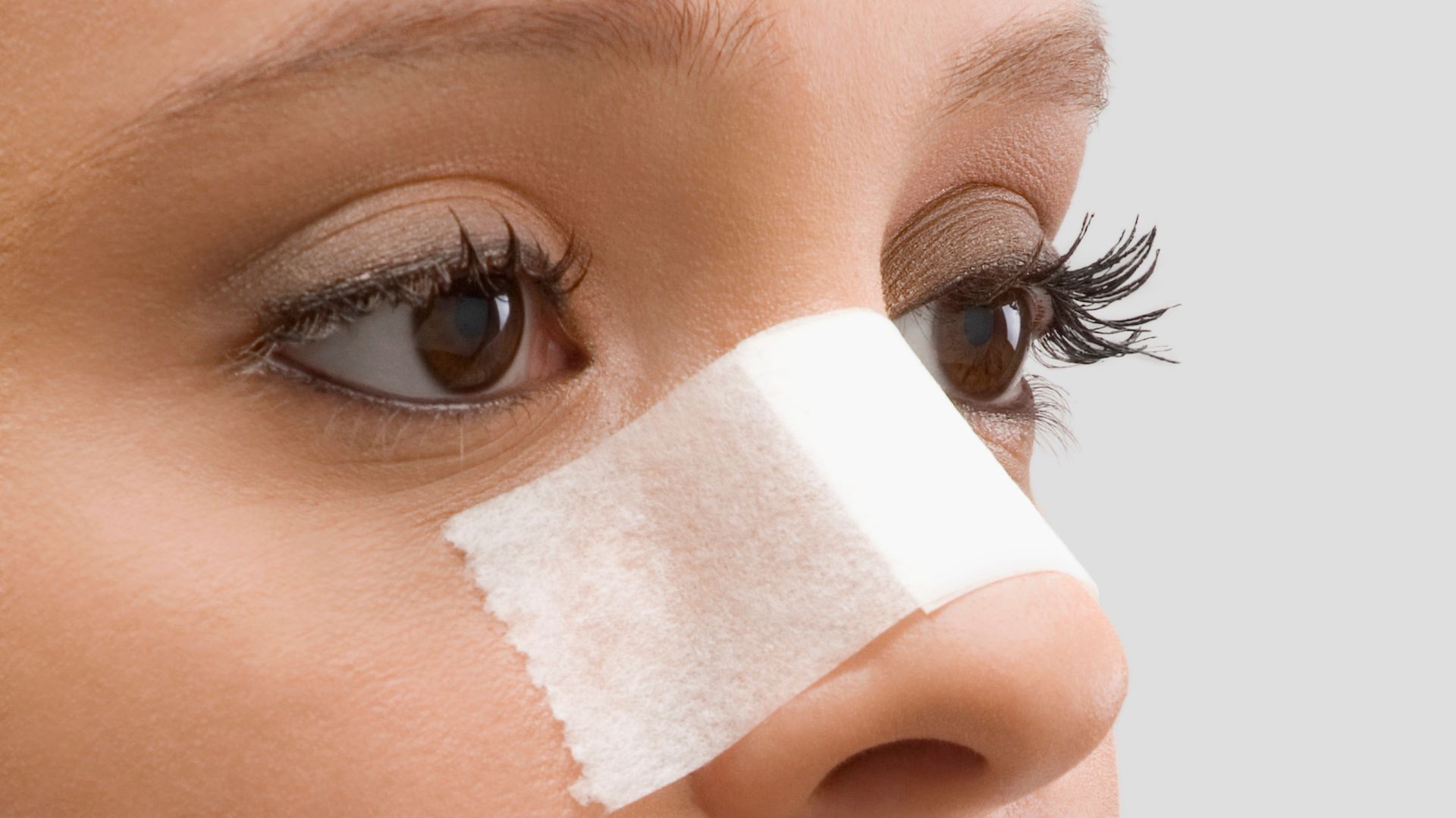Rinoplastia adolescente