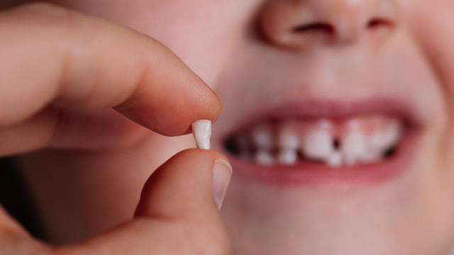 close up thumb and index finger hold the fallen or removed baby tooth front incisor with the blurred toothless mouth of the child in the background