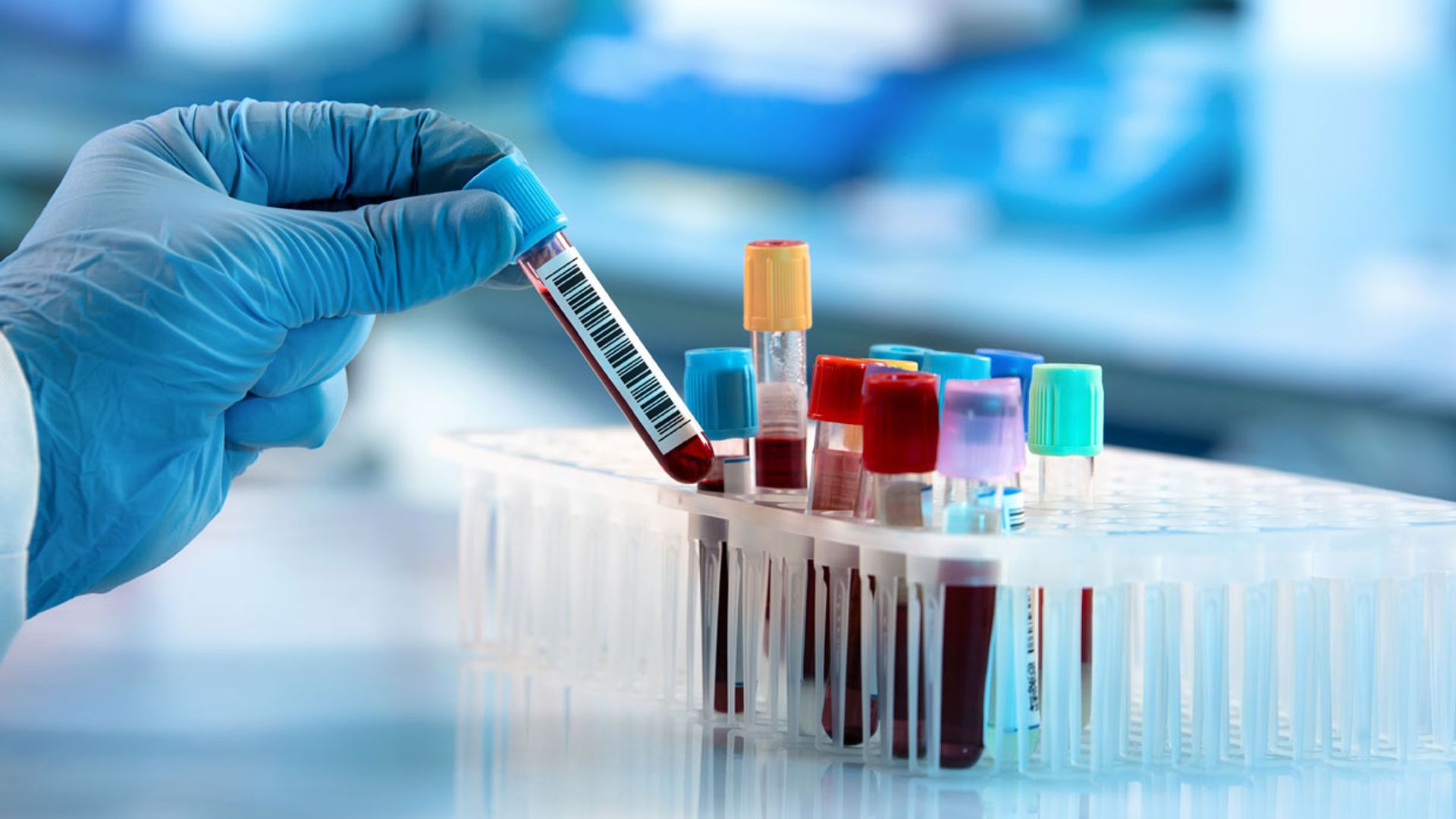 Cáncer linfático: tipos, síntomas y diagnóstico precoz