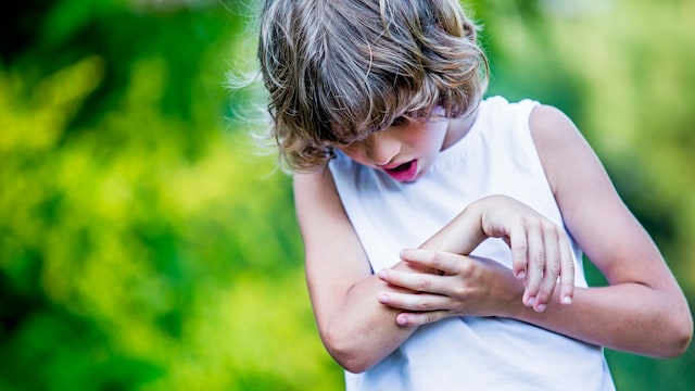 Niño se mira el brazo tras la picadura de un insecto