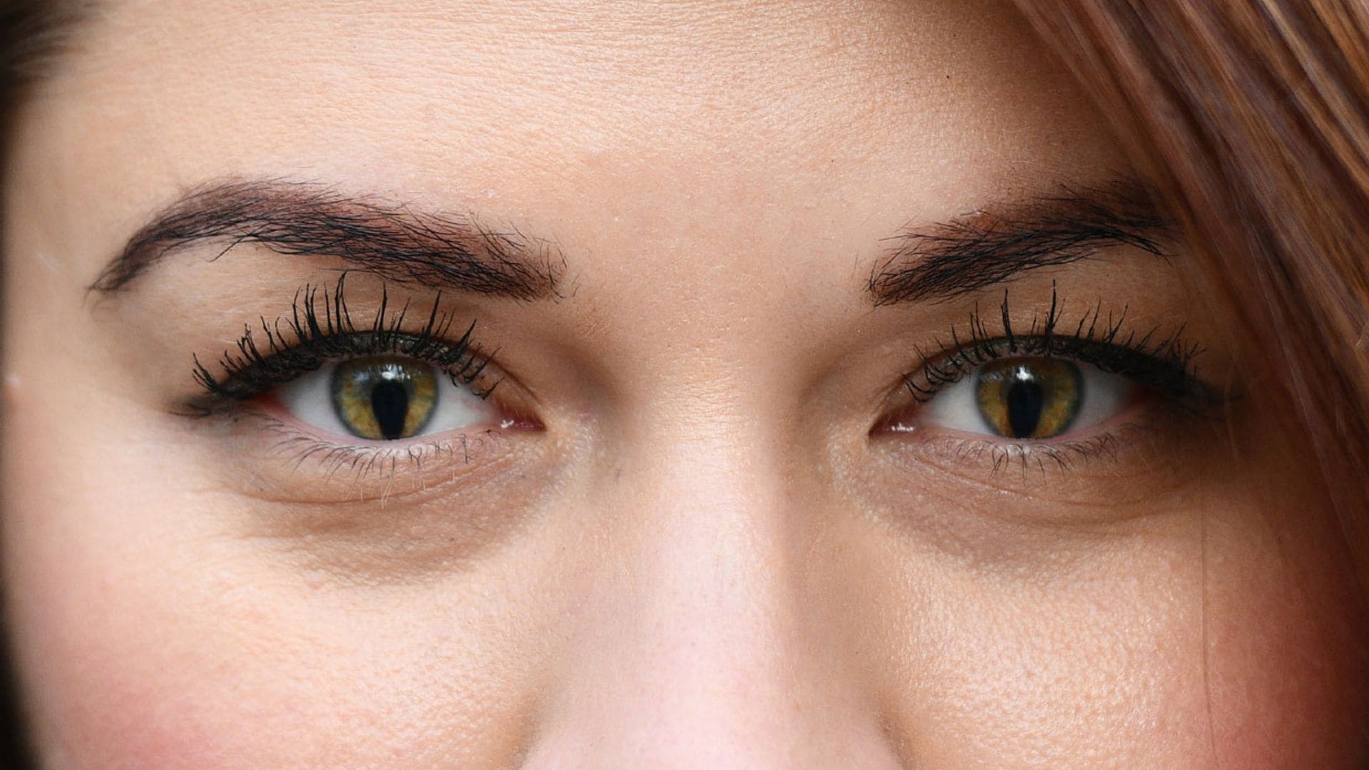 ¿Qué es el coloboma, el defecto congénito que tiene en su ojo Madeleine McCann?