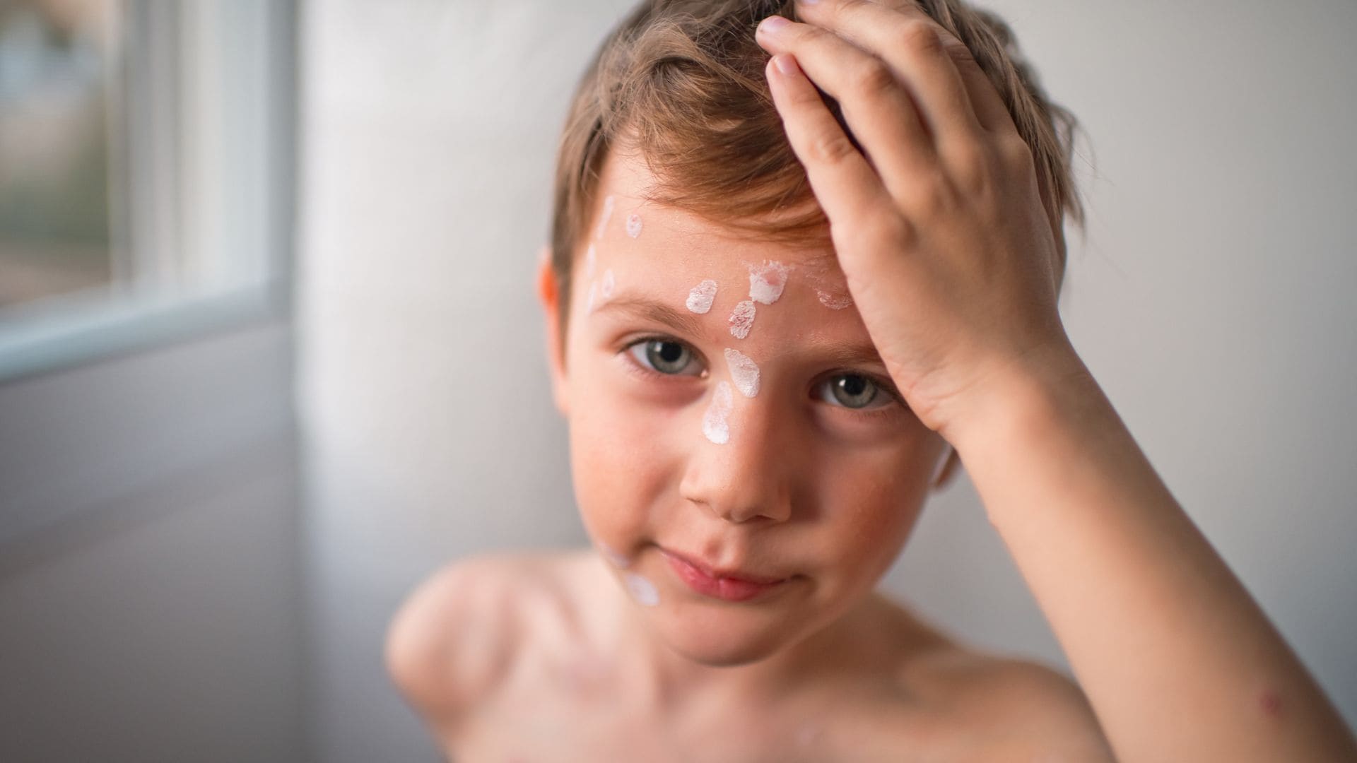 Estas son las manchas más frecuentes en la piel de bebés y niños a causa del Sol