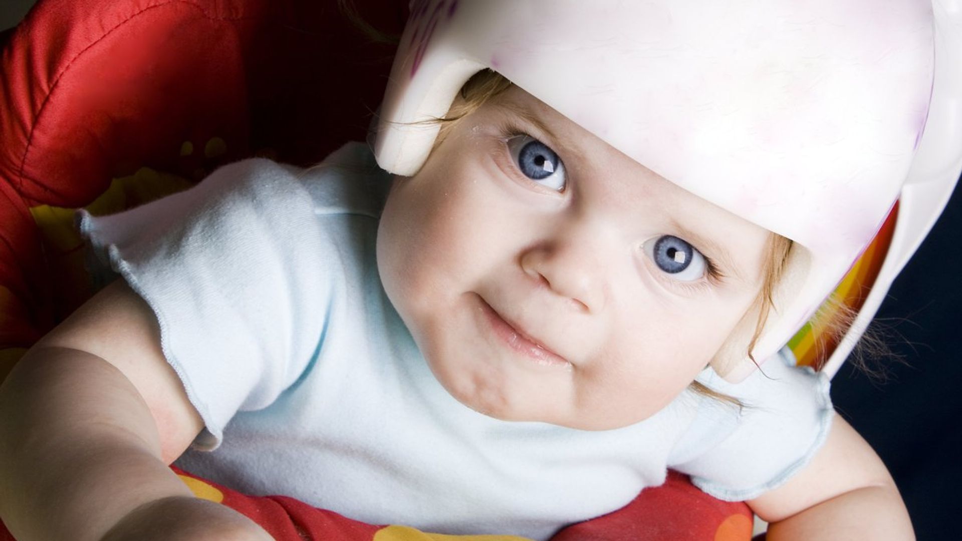 ¿Sabes cuál es el motivo por el que algunos bebés deben usar casco?