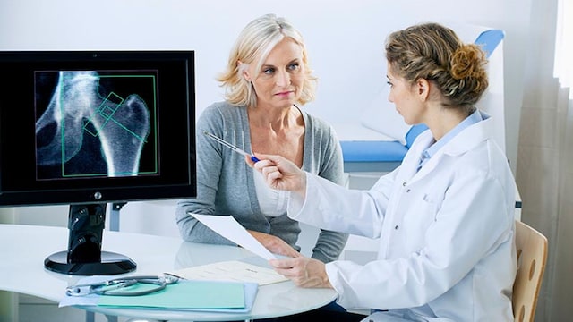 osteoporosis menopausia 1t