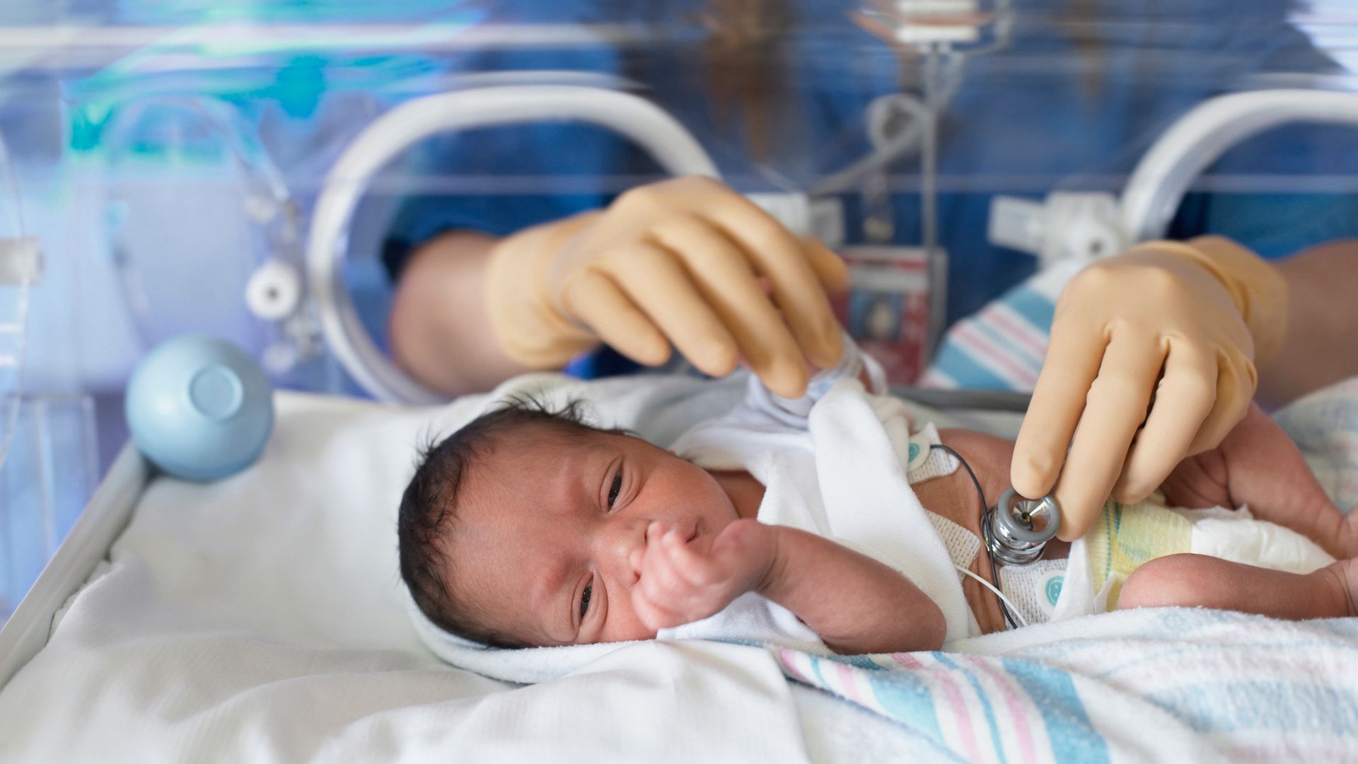 Isabel Llana Martín, pediatra, sobre las UCIS Neonatales: "Siempre que la situación clínica lo permita, los padres pueden practicar el método canguro"