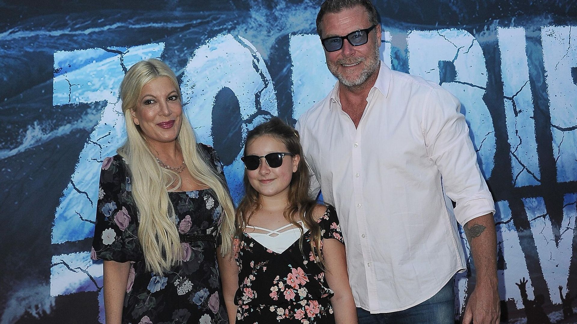 Qué es la migraña hemipléjica, la enfermedad que padece Stella, la hija de 14 años de Tori Spelling
