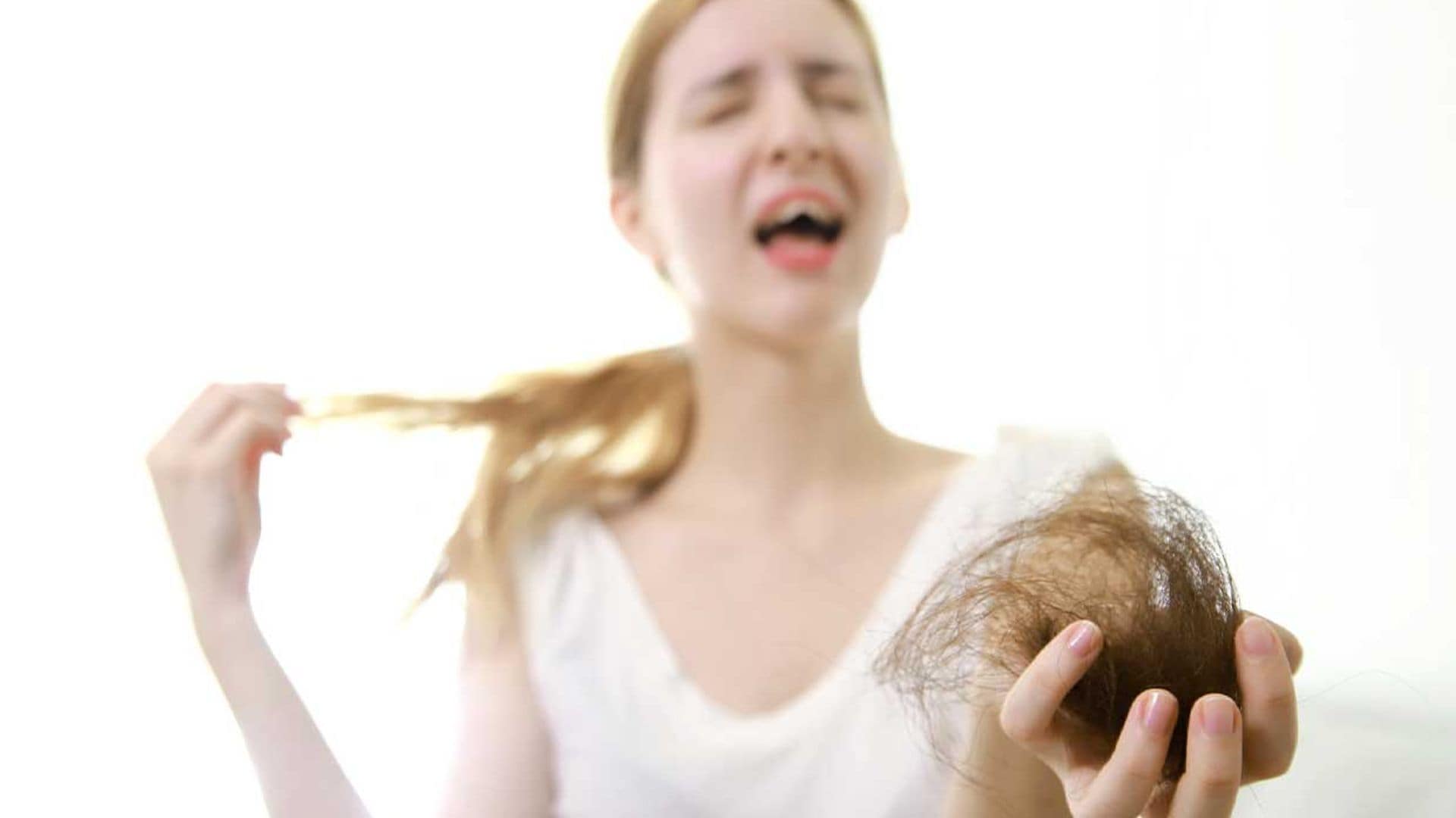 alopecia