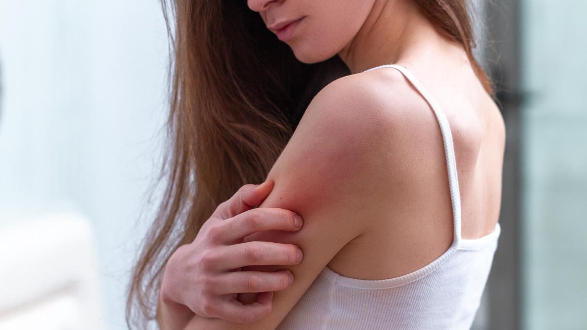 ¿Hasta qué punto influye la alimentación en la evolución de la dermatitis?