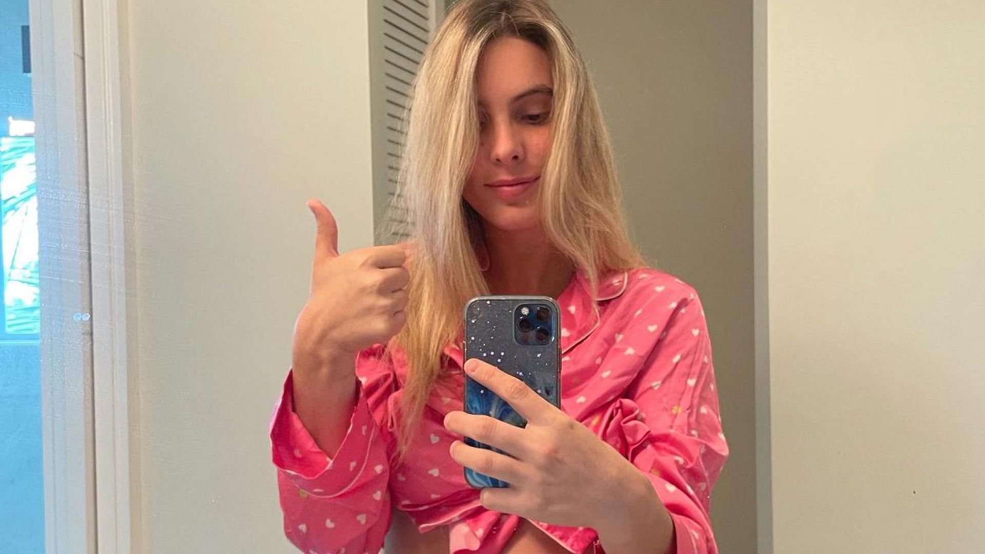 Tras su operación, Lele Pons muestra cómo quedó su abdomen