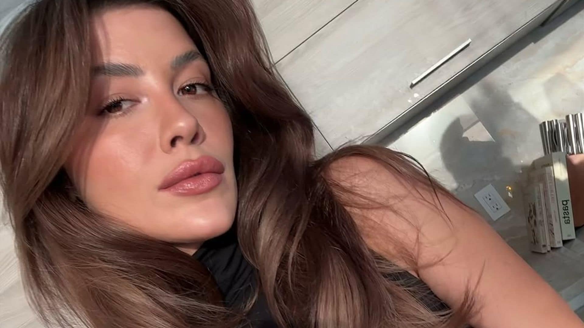 Michelle Salas se sincera sobre la condición que padece en la piel: 'Ha sido súper frustrante'
