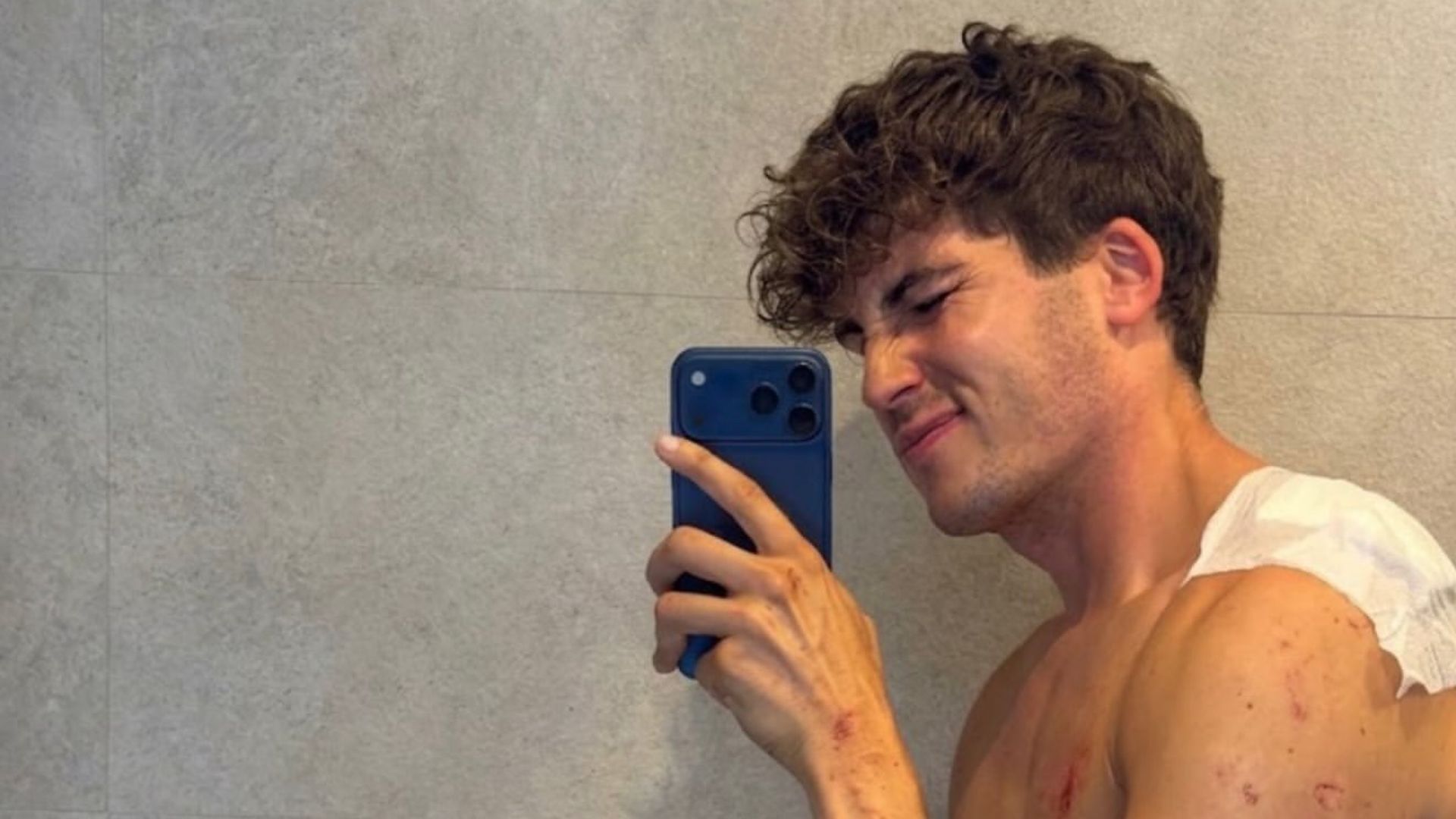 El 'influencer' Javier Gallardo sufre un grave accidente de moto en Madrid