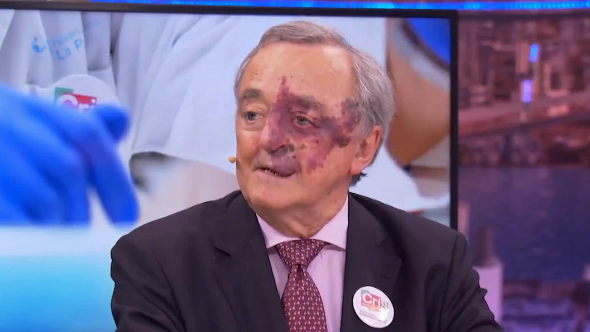 Mariano Barbacid, investigador del CNIO, ha logrado eliminar el cáncer de páncreas en ratones con una estrategia inédita basada en un ataque múltiple al tumor