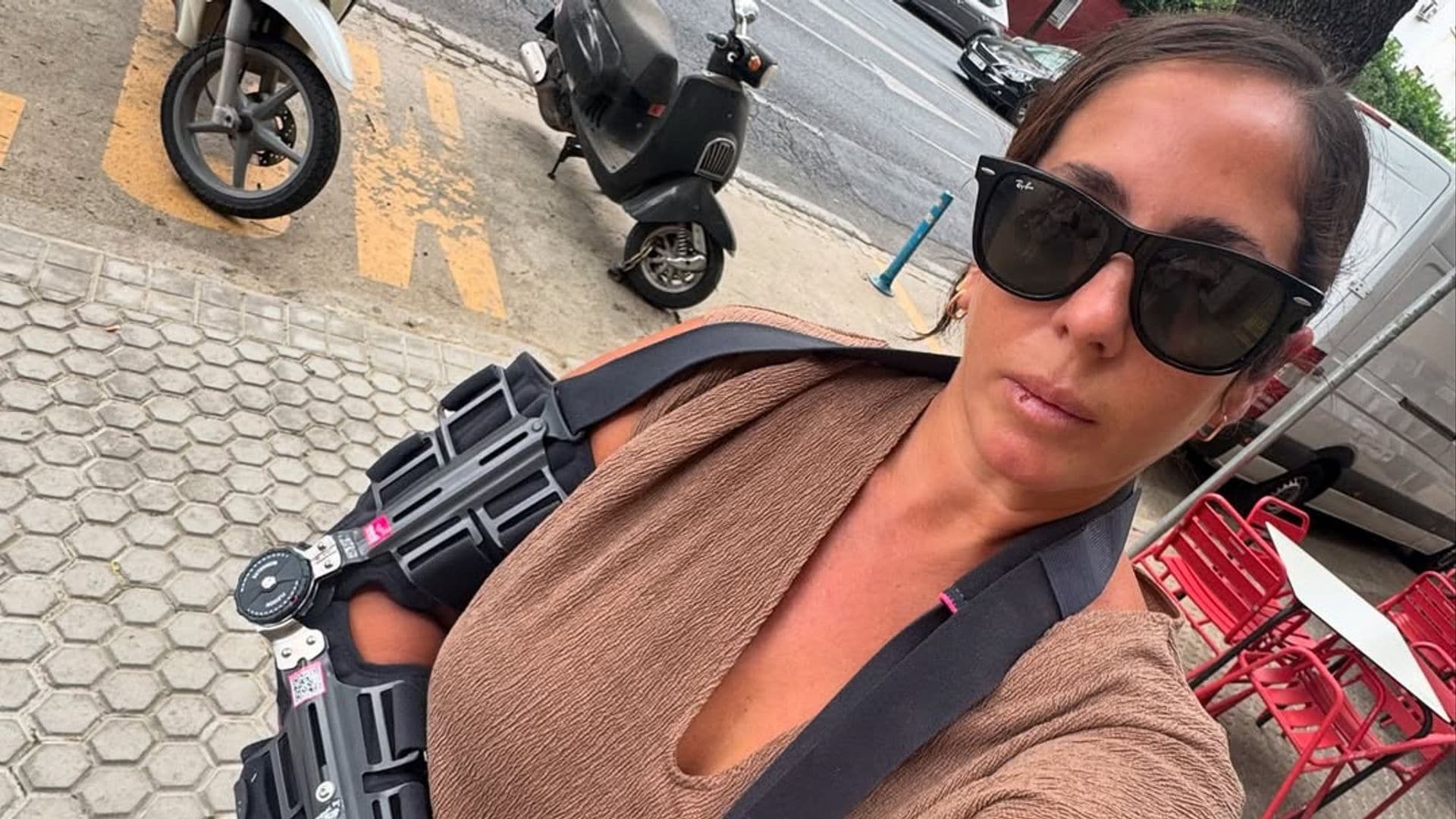 Anabel Pantoja muestra como avanza su lesión tras el accidente: "No es un muslo, es mi codo"