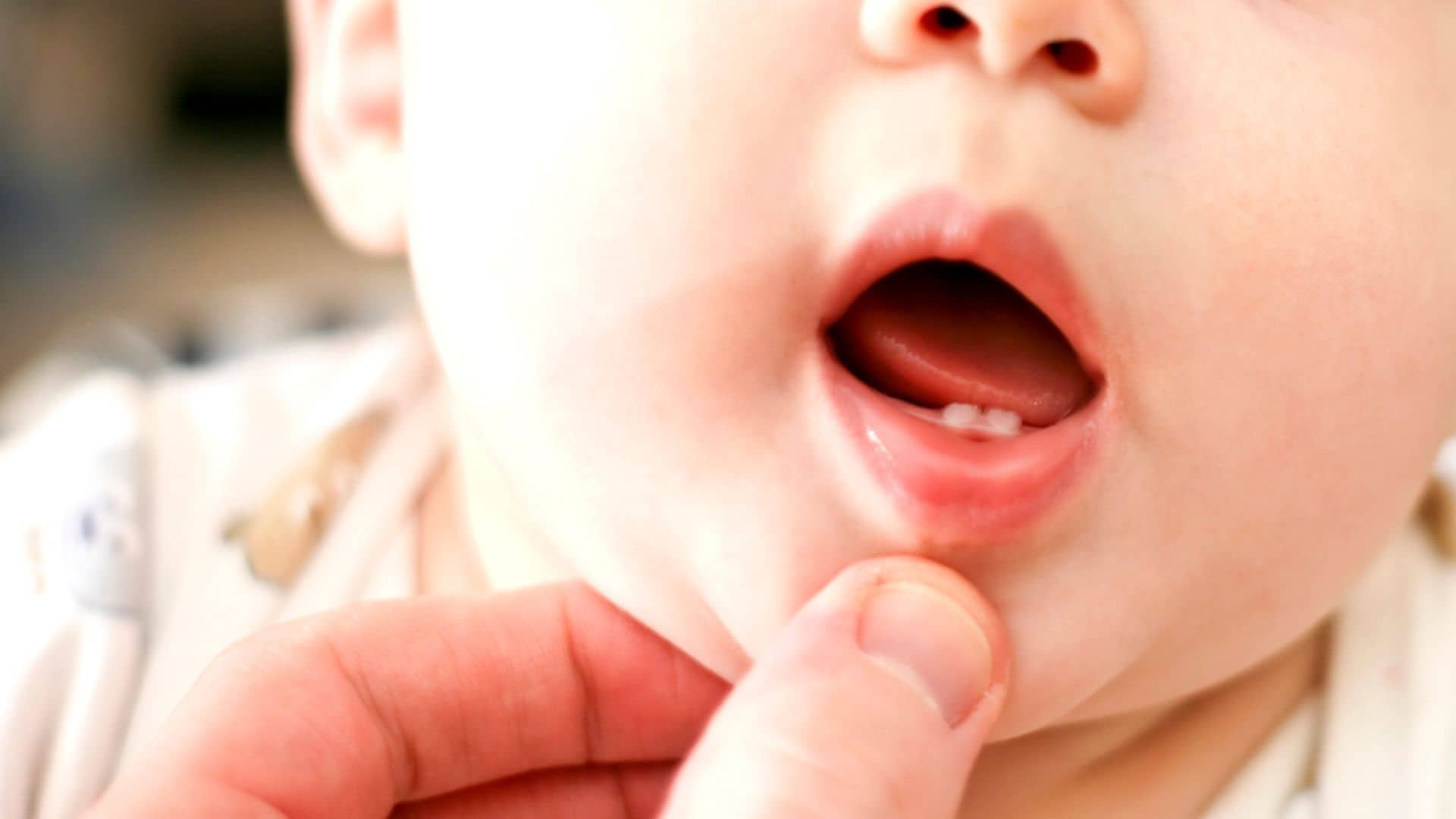 Dientes de leche