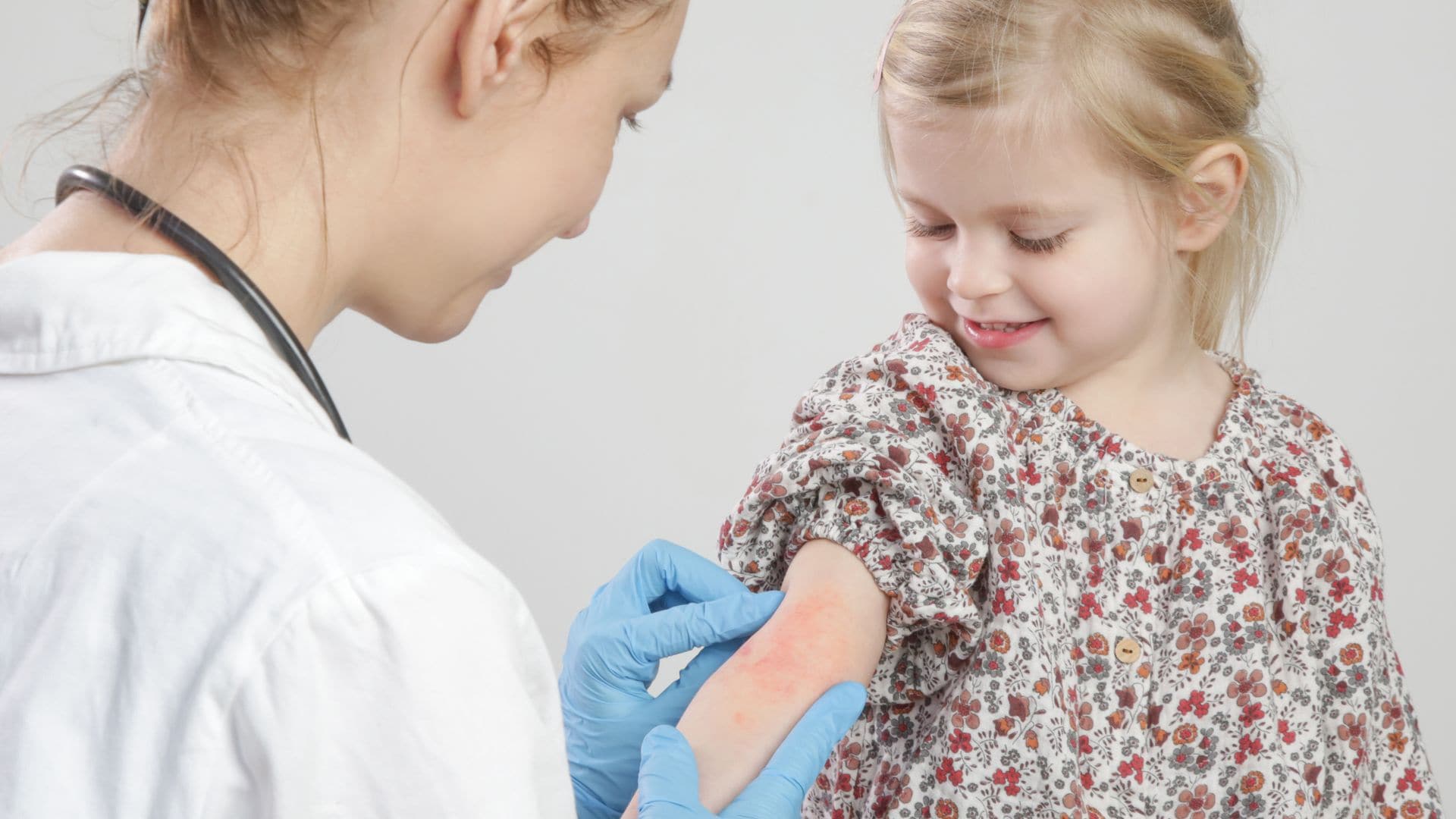 Exantema súbito en niños: guía completa para padres sobre esta erupción común