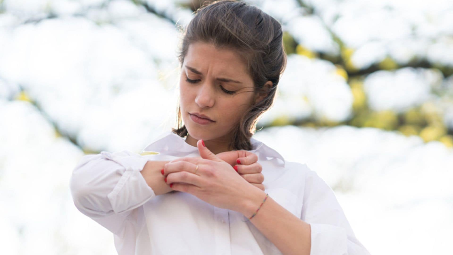 dermatitis atopica