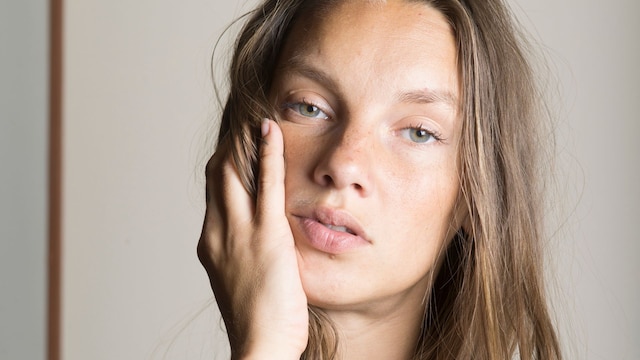Cortisol y efecto cara de luna llena