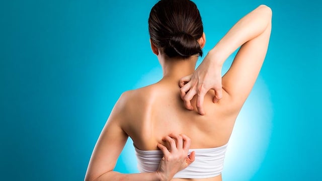 remediosdermatitis