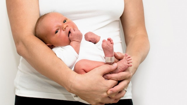 ictericia neonatal