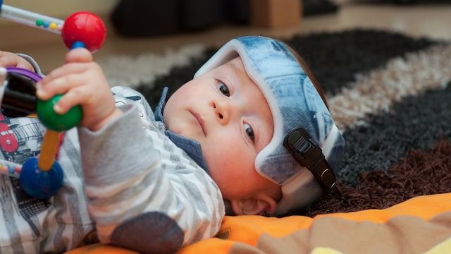 Bebé con casco ortopédico