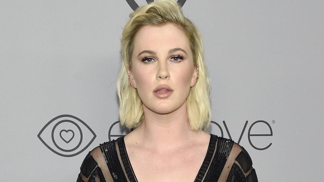 ireland baldwin3