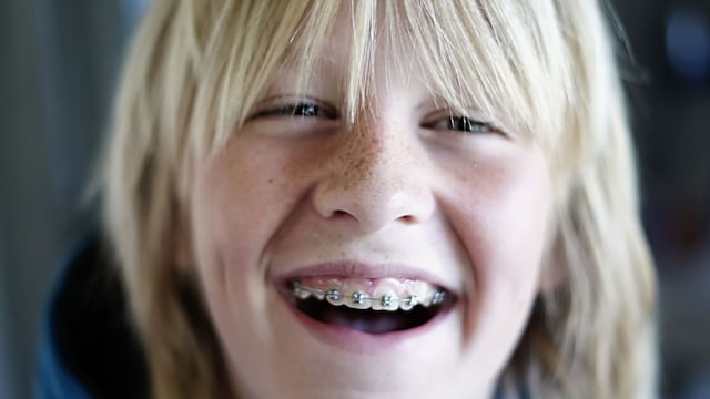 Niño con ortodoncia o brackets