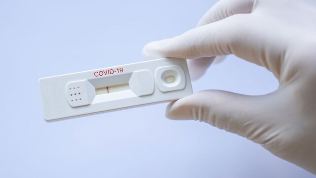 pruebas coronavirus